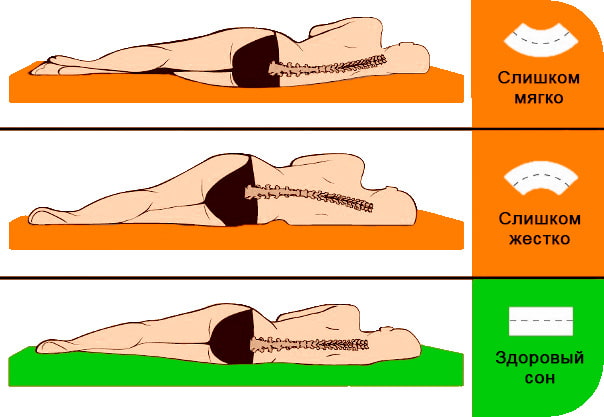 Fermeté du matelas orthopédique